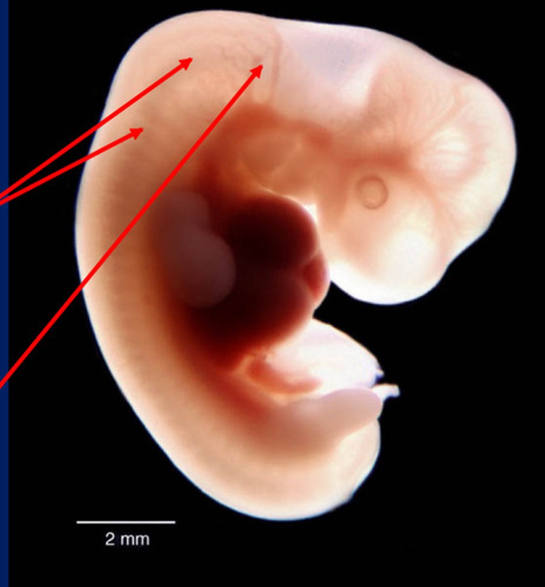<p>group of cells that develops from the embryo's ectoderm and contributes to the development of many vertebrate structures (bottom arrow)</p>