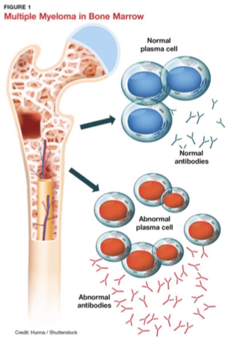 <p>Multiple myeloma accounts for _____ of biopsied bone tumors</p>