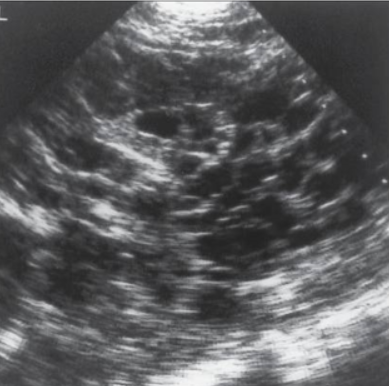 <ul><li><p>requires background info</p></li></ul><p></p>