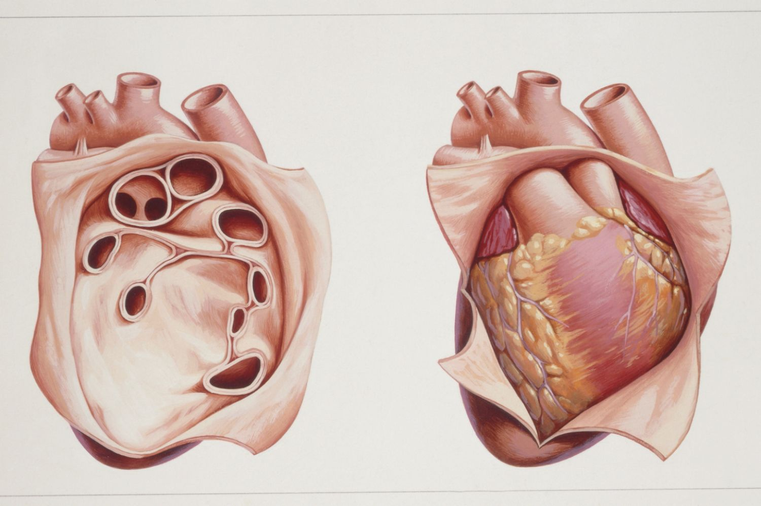 <p>Pericardium</p>