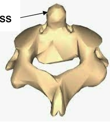 <ul><li><p>C2</p></li><li><p>Found beneath atlas, contains odontoid process (dens) </p></li></ul><p></p>