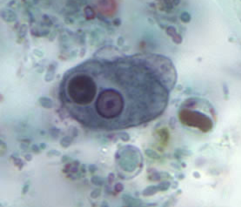 <p>Identify this organism based off its trophozoite form</p>