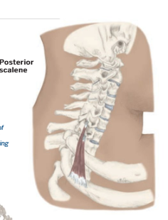 <p>Posterior scalene</p>