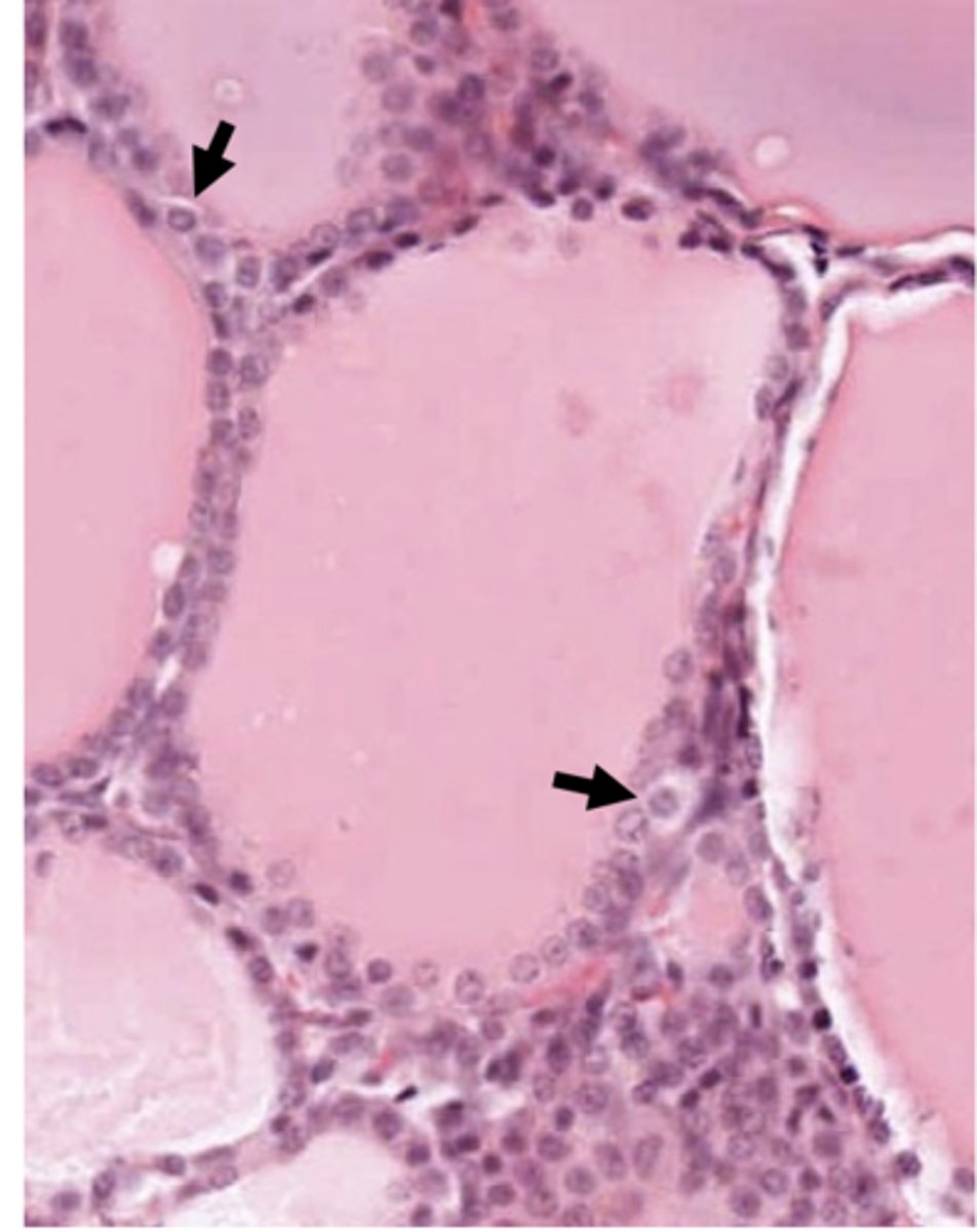<p>What are the arrows pointing to?</p>