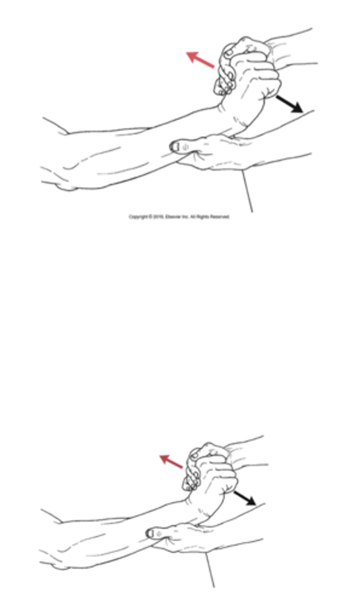 <p>What test is being performed in the image?</p>