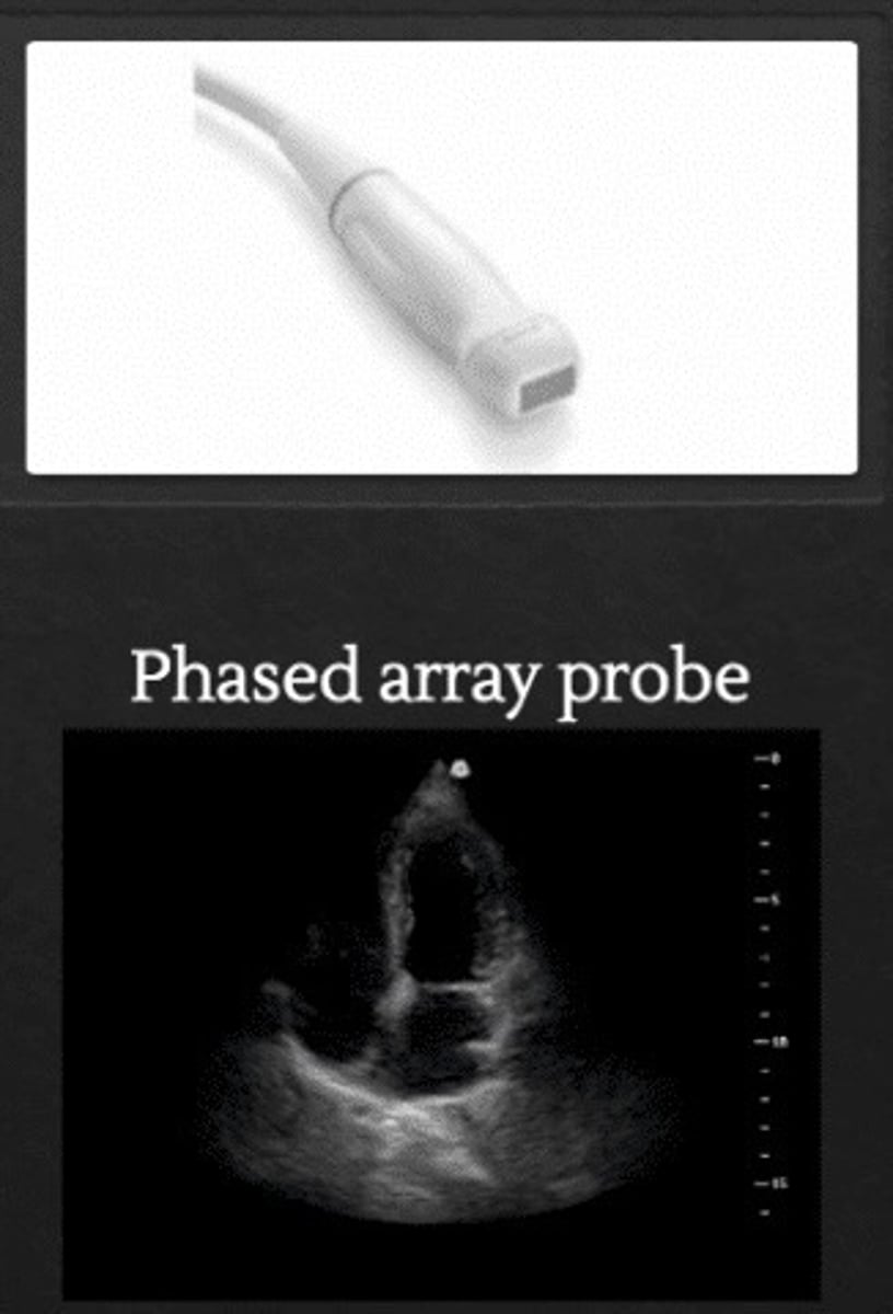 <p>Pie shaped sector, smaller probe face and creates a wider sector than curved</p>