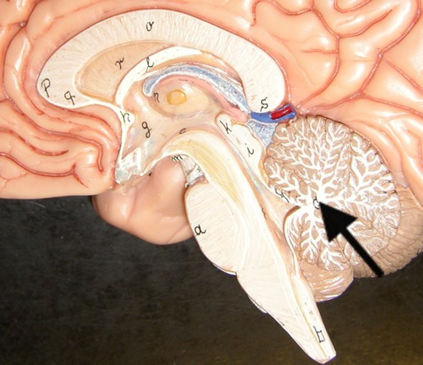 <p>-Cerebellum</p><p>-"tree of life"</p><p>-branching white mater</p>