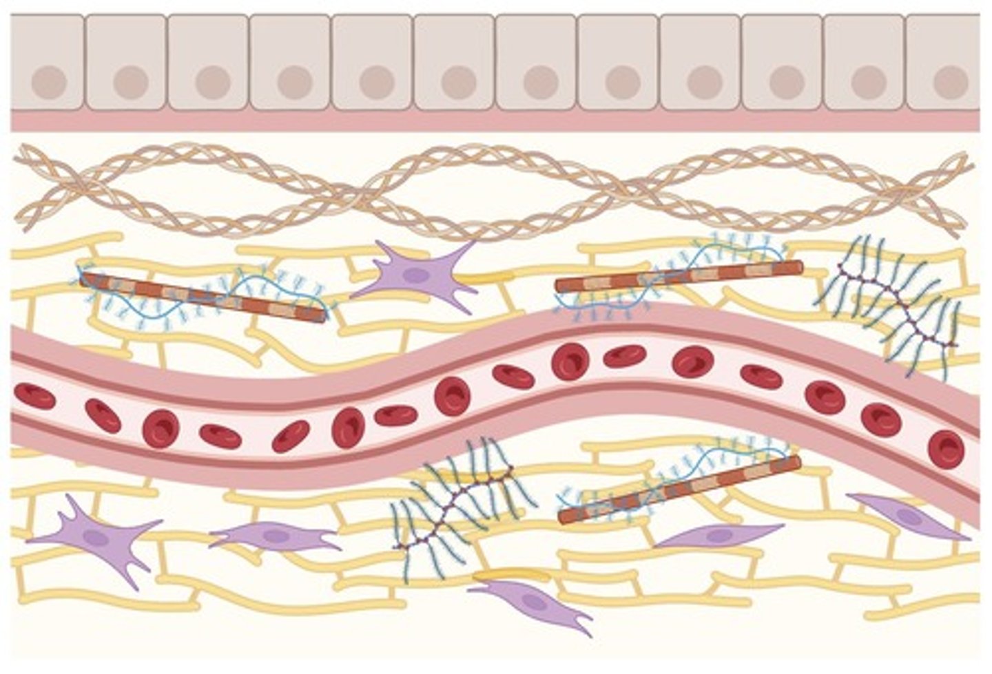 <p>Loosely dispersed cells in a matrix with extensive extracellular material</p>