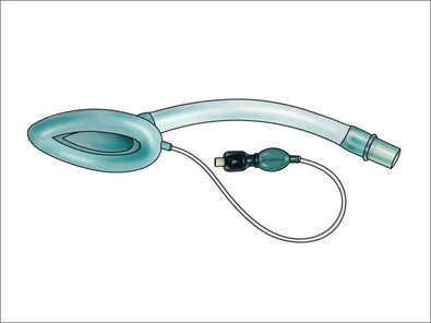 <p>Laryngeal Mask Airway </p>