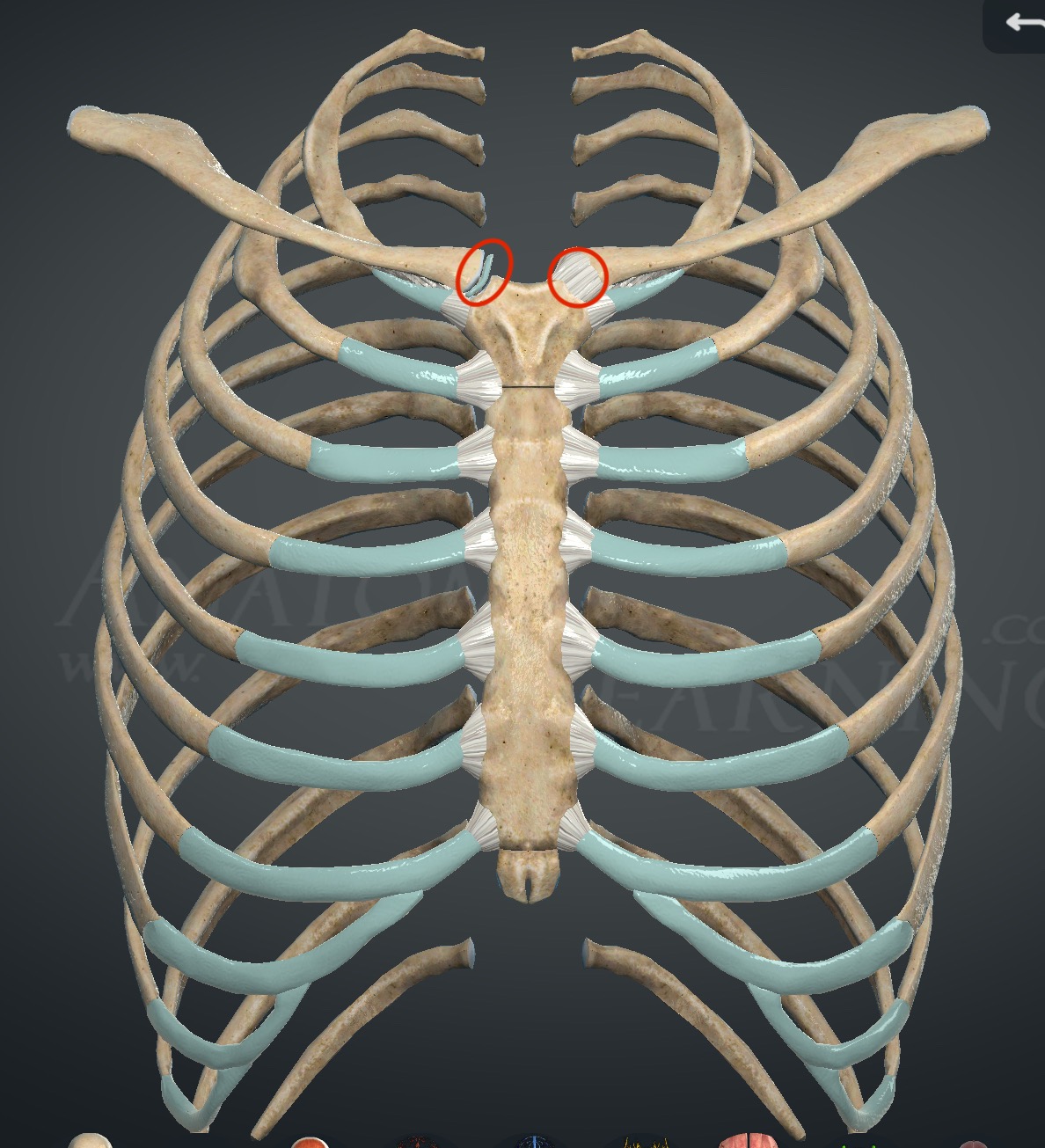 <p>What joints are these?</p>