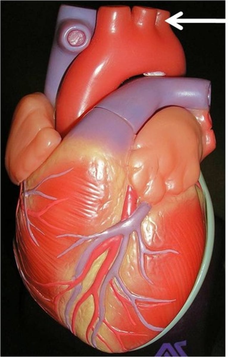 <p>the third branch of the aortic arch that distributes blood to the left arm</p><p>*commonly utilized during bypass surgery</p>