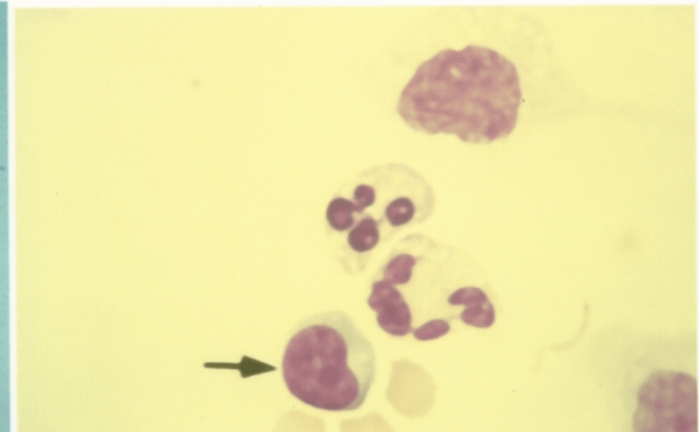 <p>Identify the cells in this body fluid</p>