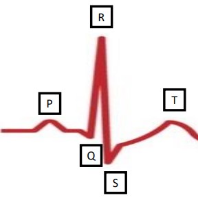 What does an ECG do?