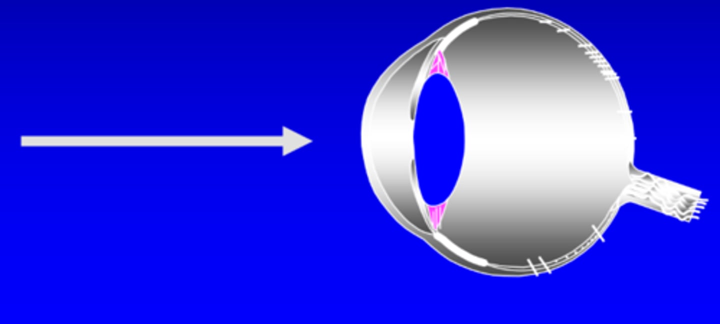 <p>direct intrabeam viewing, straight from source into eye</p>