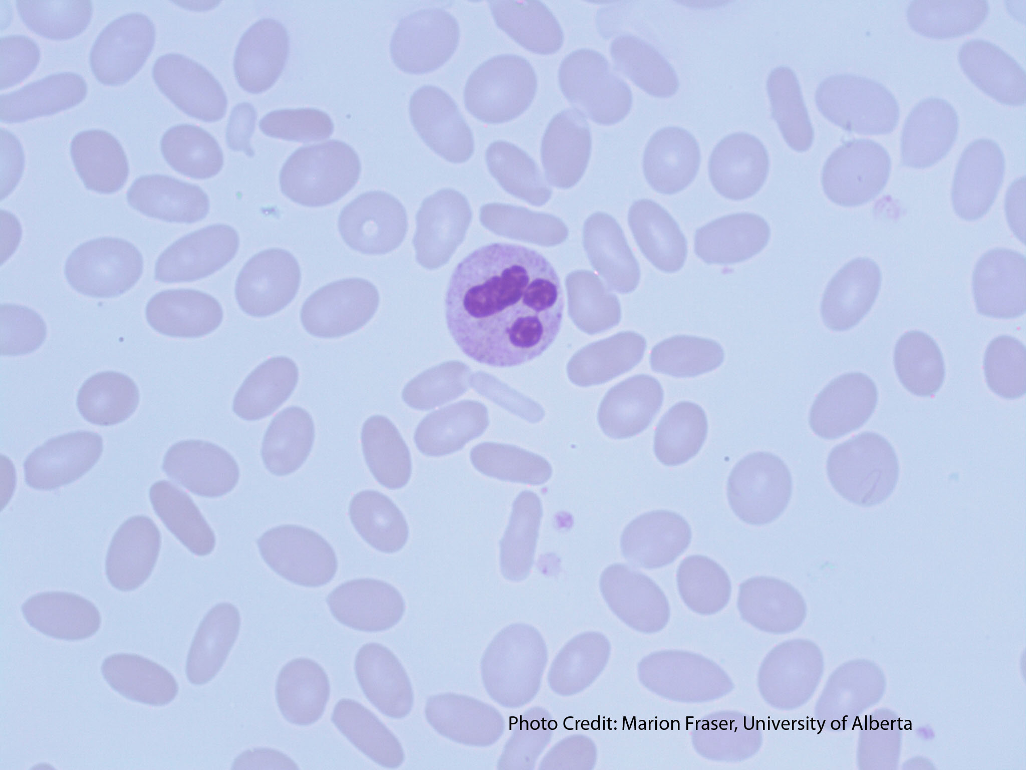 <ul><li><p>egg-shaped and disc-shaped (respectively)</p></li></ul><ul><li><p>caused by thalassemia or megaloblastic anemia</p></li><li><p>elliptocytes stem from abnormal spectrin (an RBC membrane protein), and in serious cases, anemia</p></li></ul><p></p>