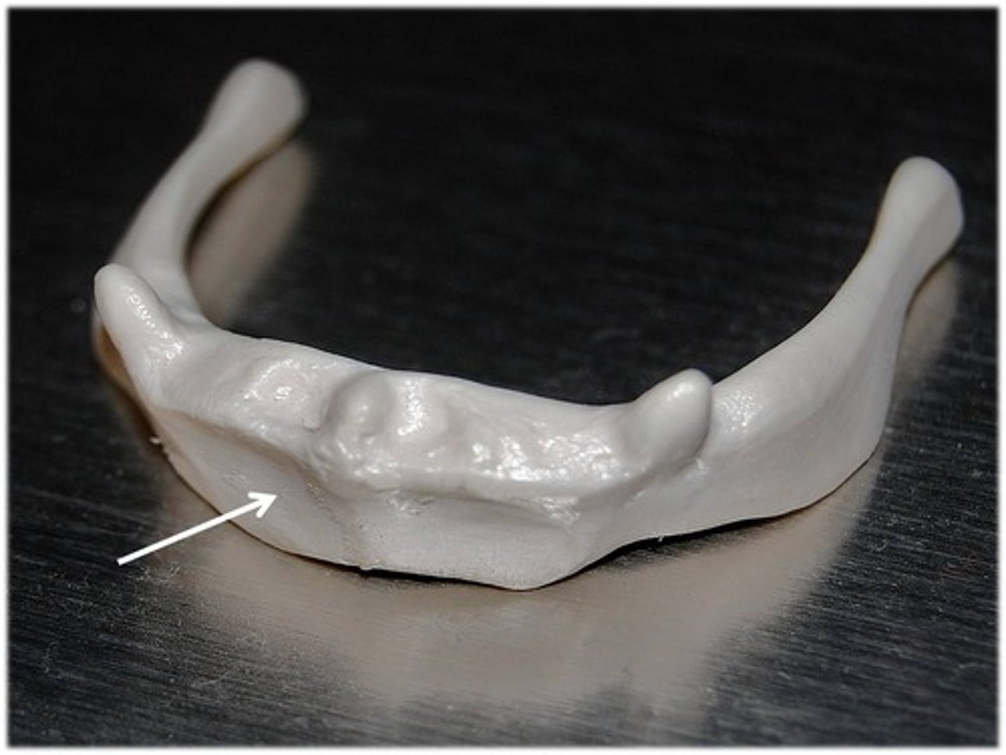 <p>horizontal surface of hyoid bone</p>