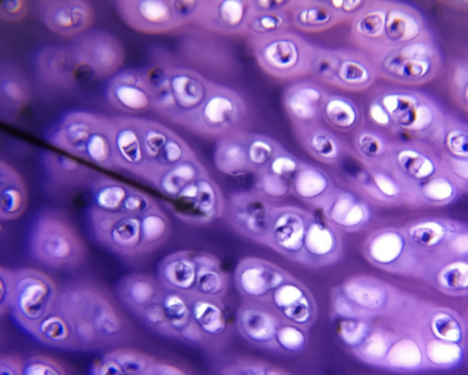 <p>what kind of cartilage is this </p>