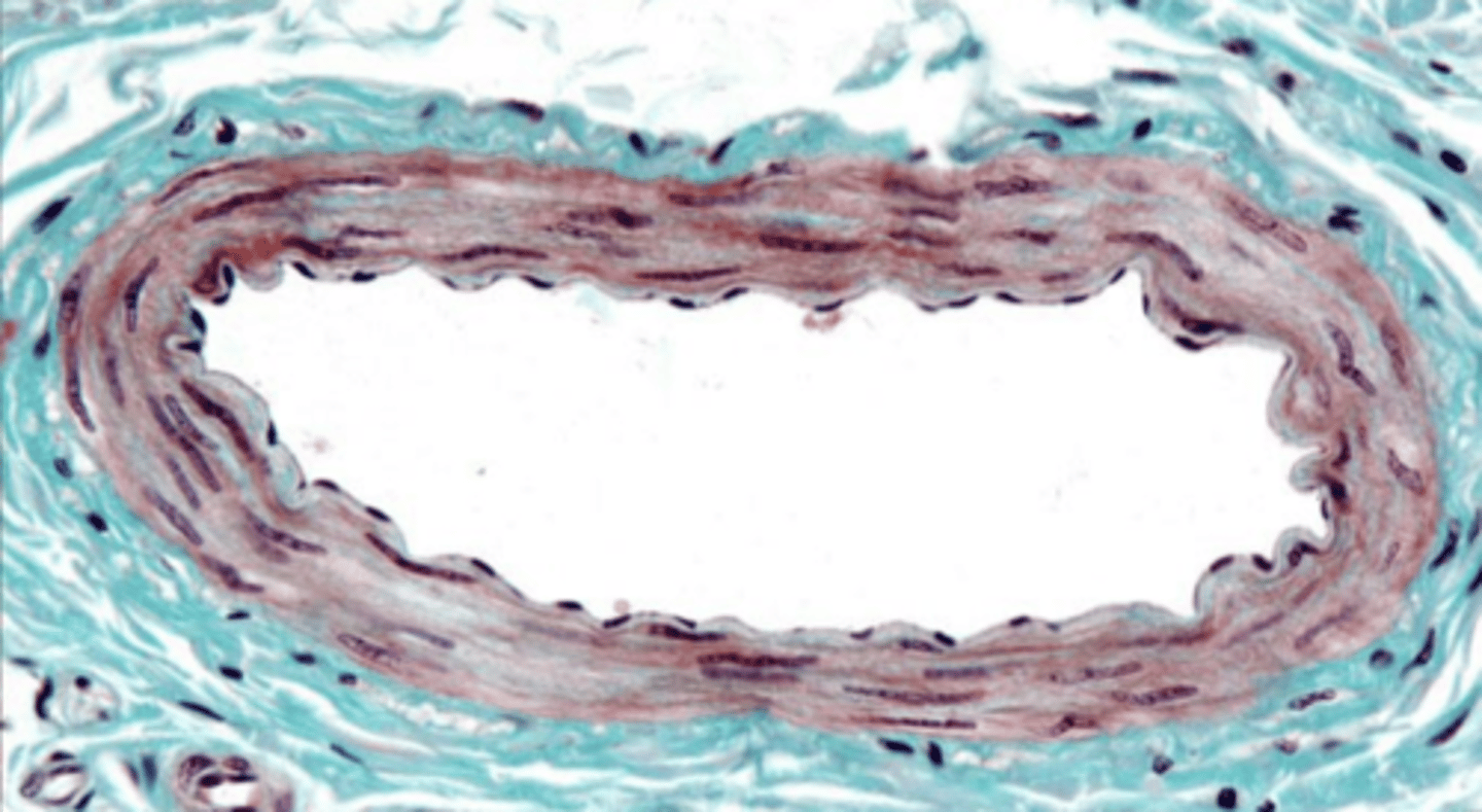<p>what type of artery?</p>