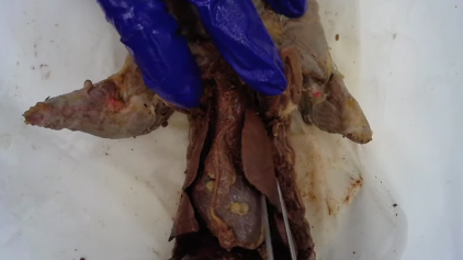 <p>Uppermost lobes of the lung</p>