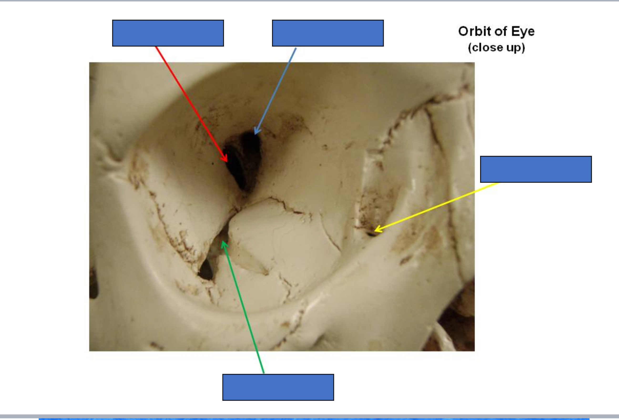 <p>Lacrimal Duct</p>