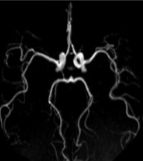 <p>What type of view are we observing the COW at?</p>