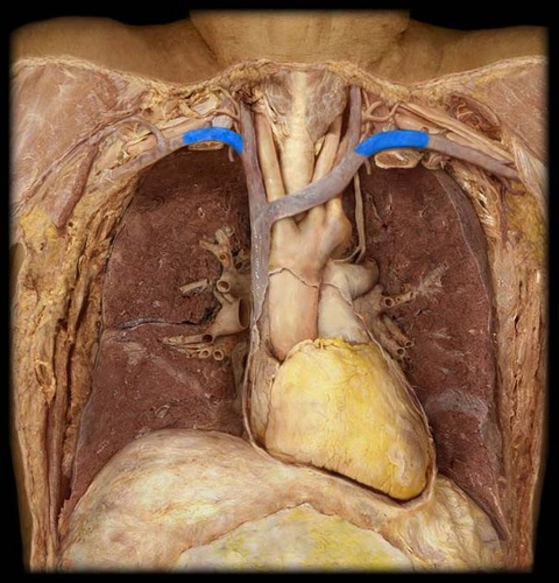 <p>identify these veins (right and left)</p>