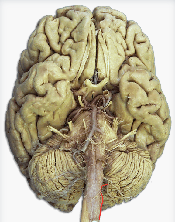 <p>Label this cranial nerve</p>