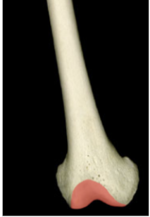 <p>Is this anterior or posterior view of the femur?</p>