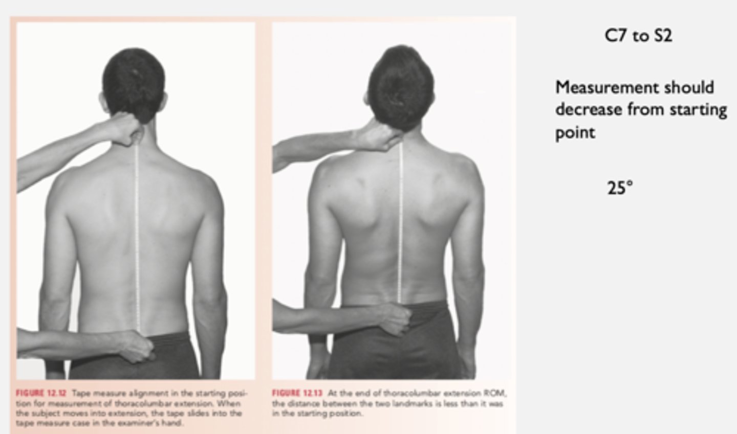 <p>spinous process T1 to S2<br><br>difference of before and after measurements</p>