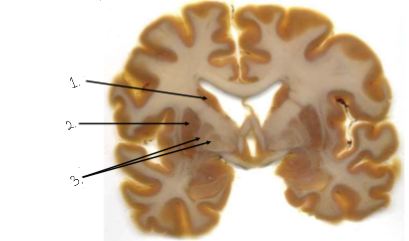 <p>label this diagram</p>