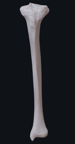 <p>What is this? right or left?</p>