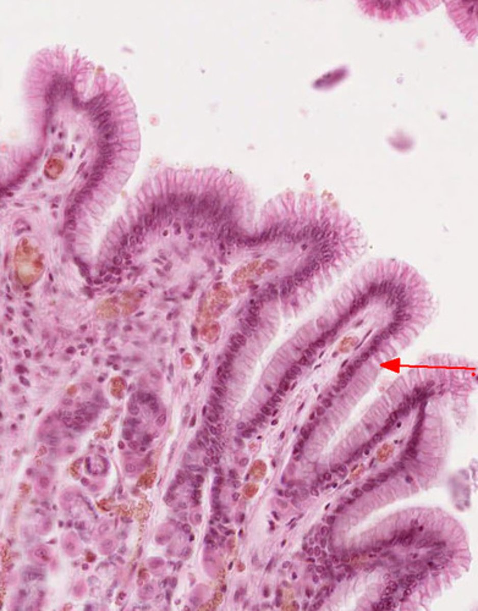 <p>Continually eroded and completely replaced by mitosis every three days.</p>