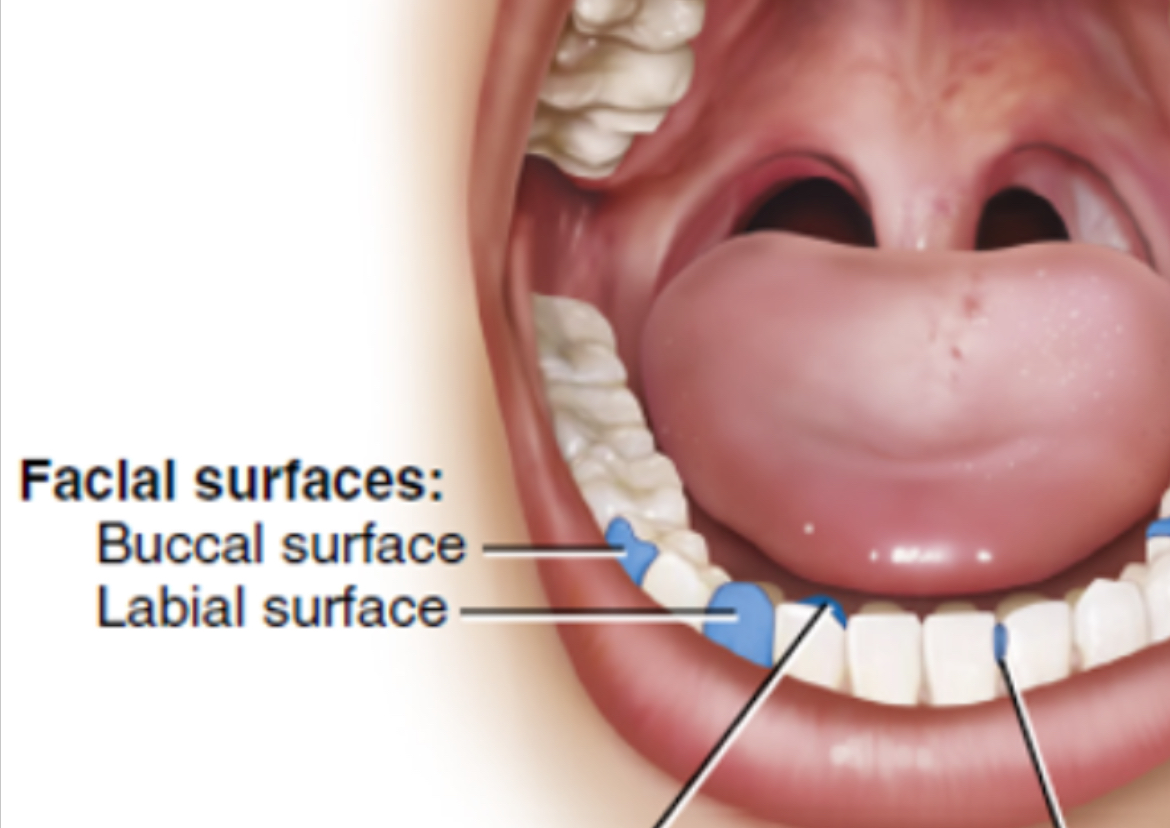<p>Labial (front teeth) or Buccal (back teeth) </p>