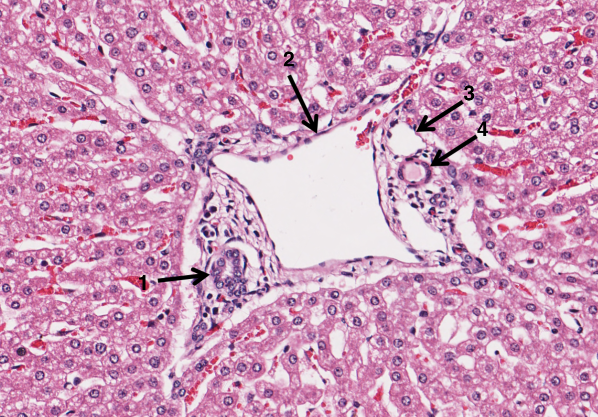 <p>What is 2 in the portal triad of a liver?</p>