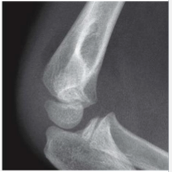 <p>What is this </p>