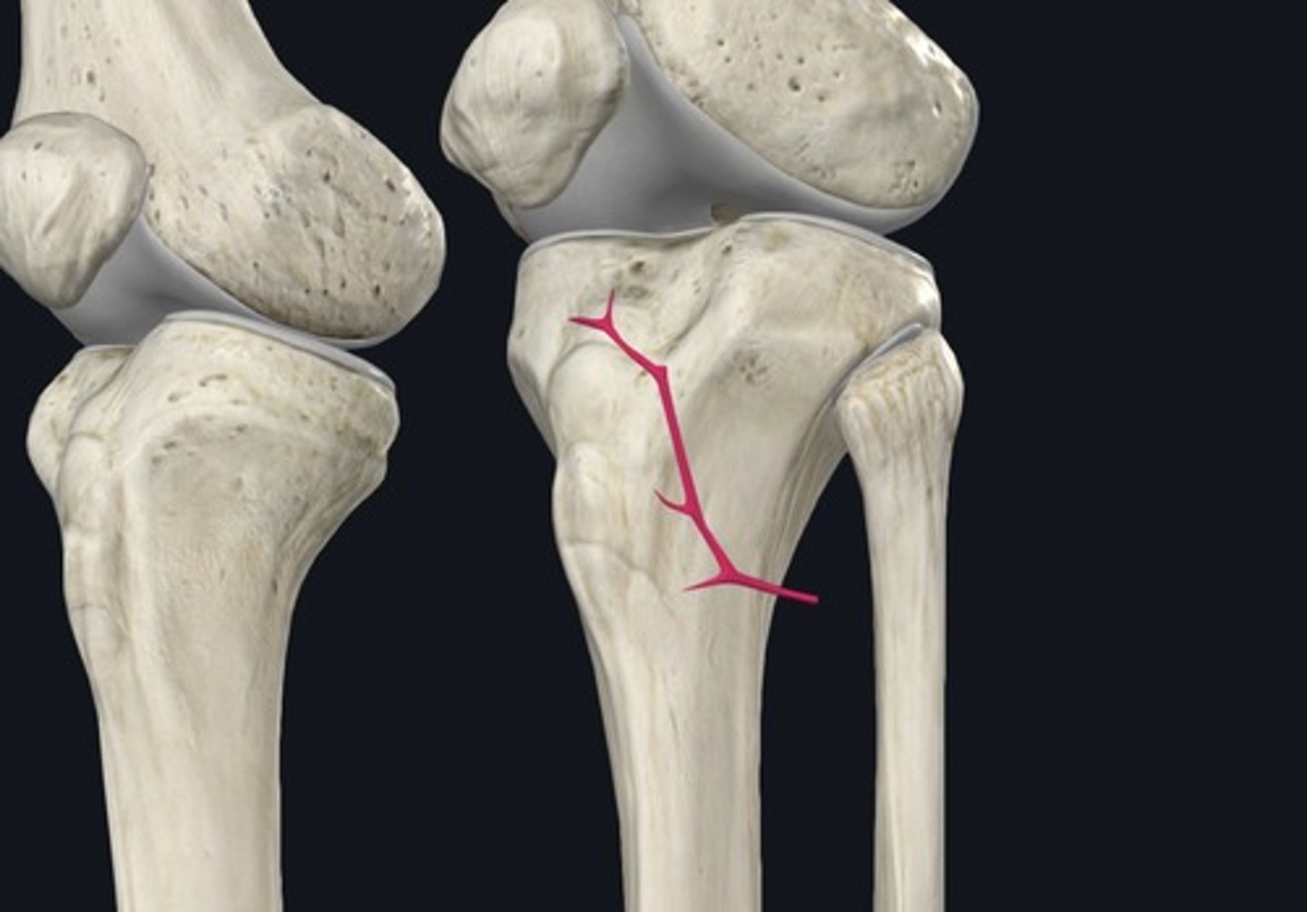 <p>A branch of the posterior tibial artery that courses around the neck of the fibula. Supplies the knee area.</p>