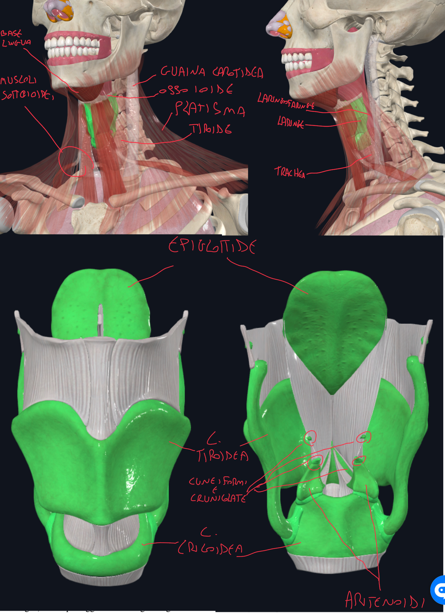 <p>Laringe:</p><ul><li><p>Lunga circa 6 cm, a livello C3 a C6</p></li><li><p>Posizione: anteriormente la laringofaringe, nel triangolo anteriore del collo</p></li></ul><p>Limiti:</p><ul><li><p>Anteriore:</p><ul><li><p>Cute, sottocute, Fascia cervicale superficiale, Platisma e</p></li><li><p>Fascia cervicale profonda che si sdoppia nella lamina superficiale (che riveste trapezio e sternocleidomastoideo) e lamina pretracheale che si divide in una muscolare che riveste i muscoli sottoioidei, e una viscerale per laringe, trachea, esofago, tiroide</p></li><li><p>I muscoli sottoioidei che troviamo anteriormente la laringe sono: omoioideo, sternoioideo, sternotiroideo, tiroioideo</p></li></ul></li><li><p>Laterale → Tiroide e fascio vascolo nervoso del collo</p></li><li><p>Posteriore → Laringofaringe</p></li><li><p>Superiore → Osso ioide, base lingua, epiglottide</p></li><li><p>Inferiore → Trachea</p></li></ul><p>Sospensione della Laringe:</p><ul><li><p>La Laringe è sospesa all’osso ioide e base della lingua</p></li><li><p>Questo è importante perché durante la deglutizione si sollevano e la laringe segue il movimento determinando:</p><ul><li><p>Abbassamento epiglottide che chiude l’adito laringeo</p></li><li><p>Passaggio bolo verso l’esofago</p></li></ul></li></ul><p>Scheletro Cartilagineo della Laringe (9):</p><ul><li><p>Impari:</p><ul><li><p>Tiroide, Cricoide, Epiglottide (cartilagine elastica)</p></li></ul></li><li><p>Pari:</p><ul><li><p>Aritenoidi</p></li><li><p>Croniculate e Cuneiformi </p></li></ul></li></ul><p></p>