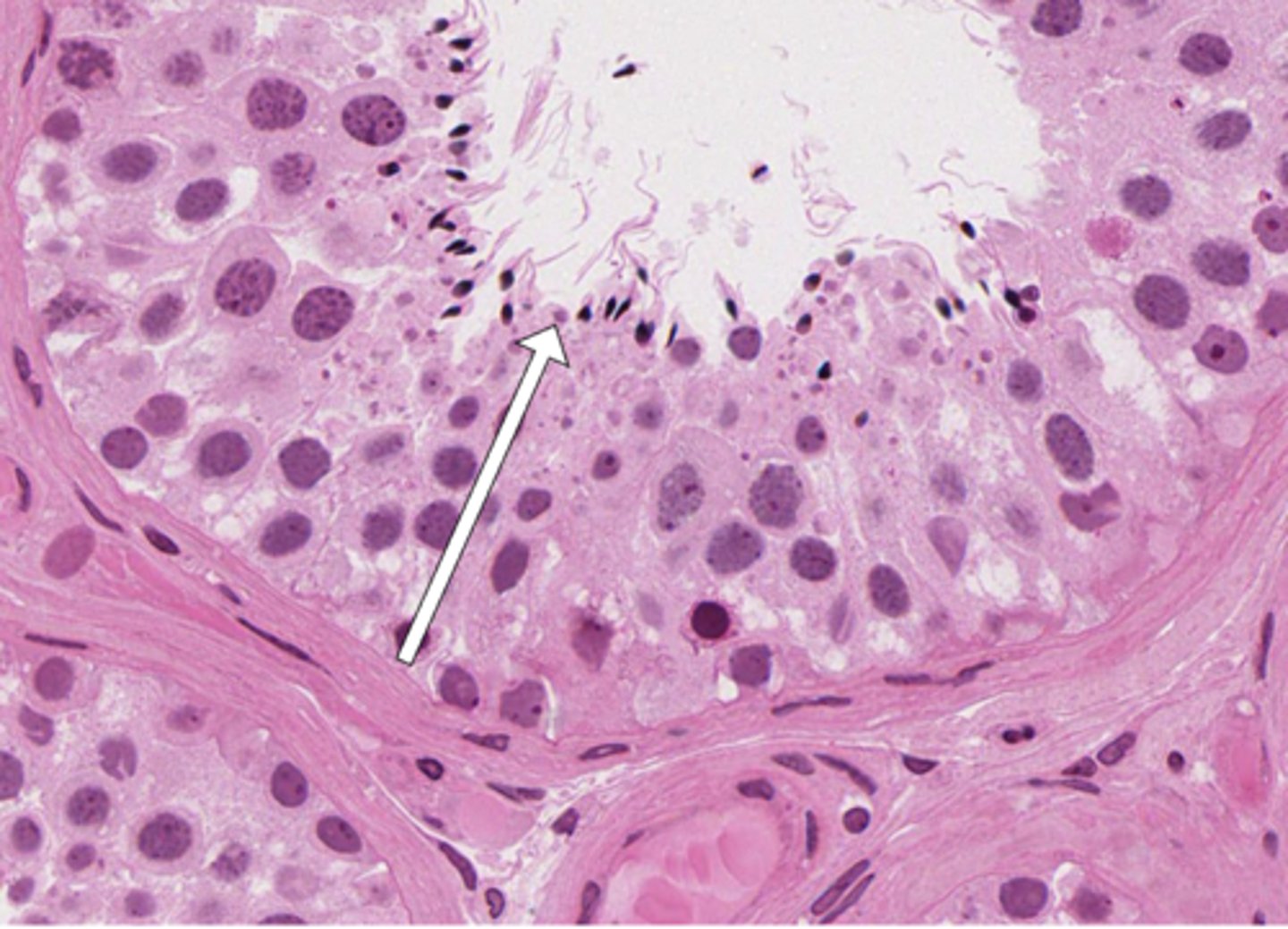 <p>Which part of the testis? What is the arrow pointing to?</p>