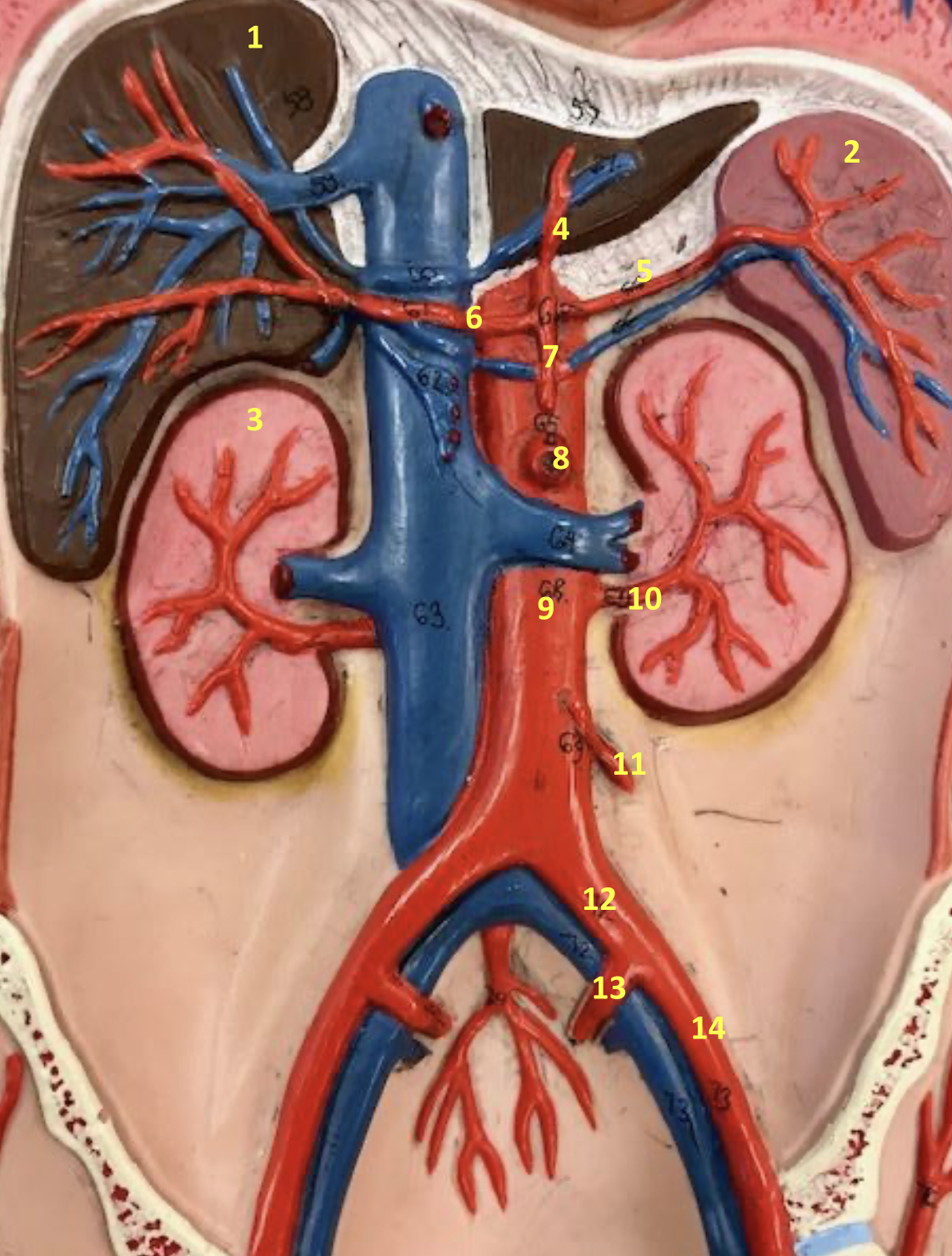 <p>Identify blood vessel 3</p>
