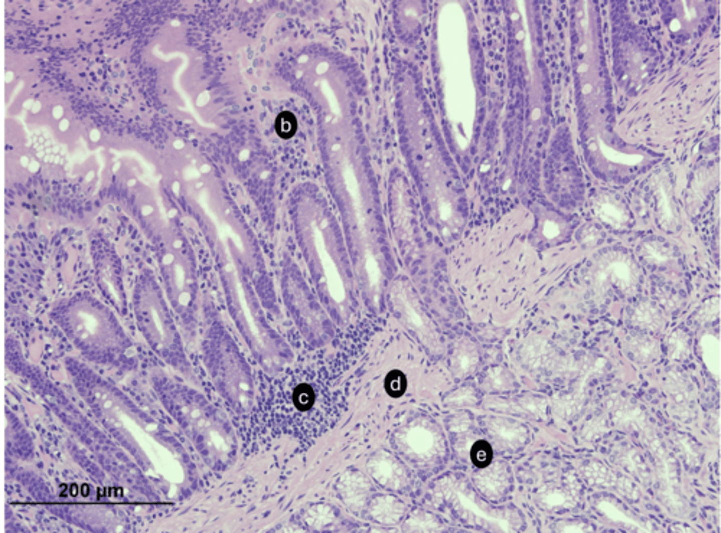 <p>D) ID the labeled structure</p>