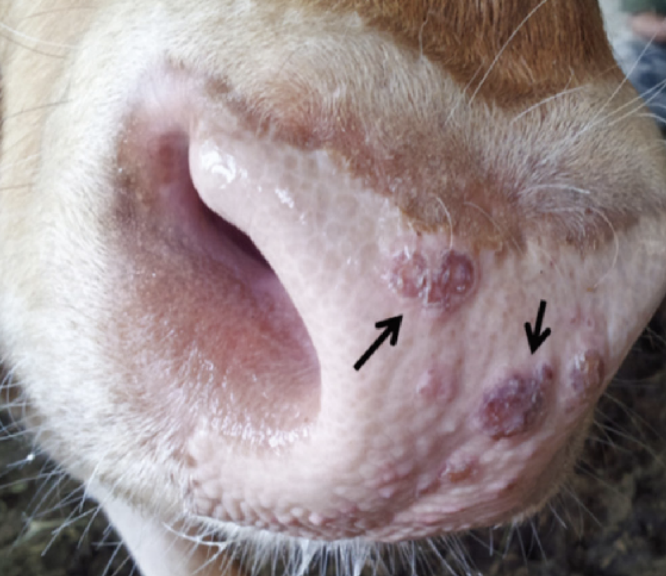 <p>epidermitis causes small, red raised nodules</p><p>nodules may have a depressed or eroded center</p>