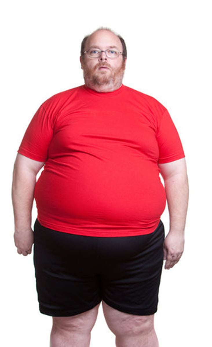 <p>having an <b>excess amount</b> of <b>body fat</b><br>- taking <b>more energy</b> in <b>than needed</b><br>- excess energy <b>stored as fat</b><br>- causes diabetes <br>- causes <b>clots</b>: <b>not</b> enough <b>oxygen supplied</b> which can cause a <b>heart attack</b> <br><br>- some fat is <b>essential</b> to <b>cushion organs</b> and <b>insulate</b></p>