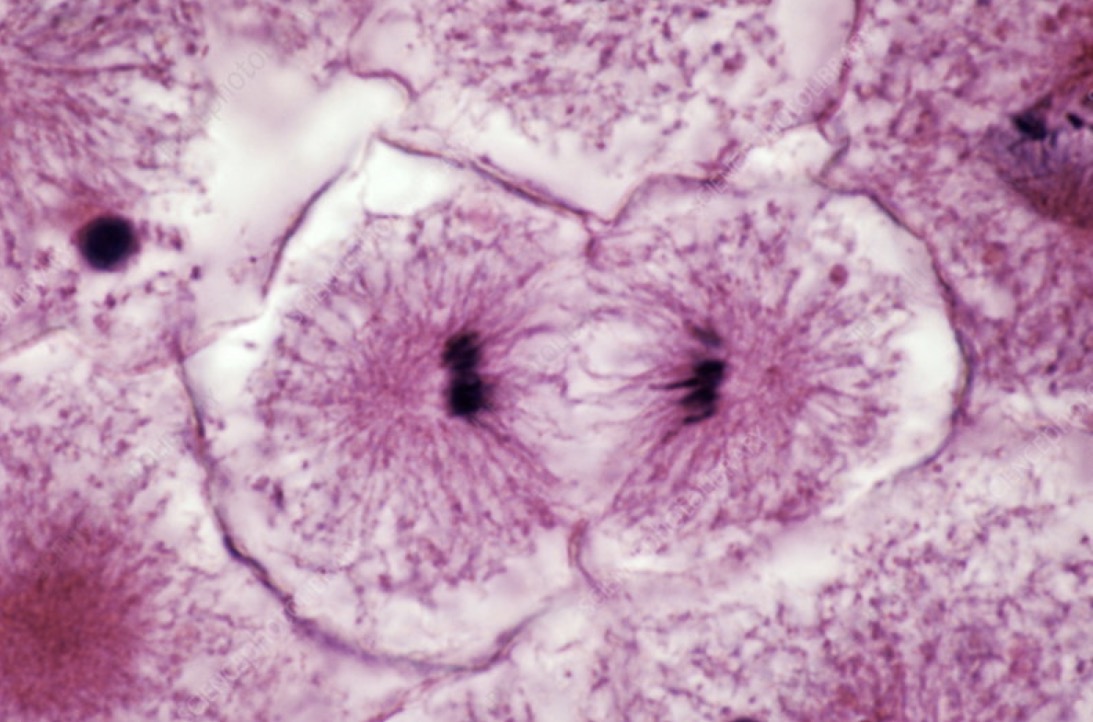 <p>Telophase</p>