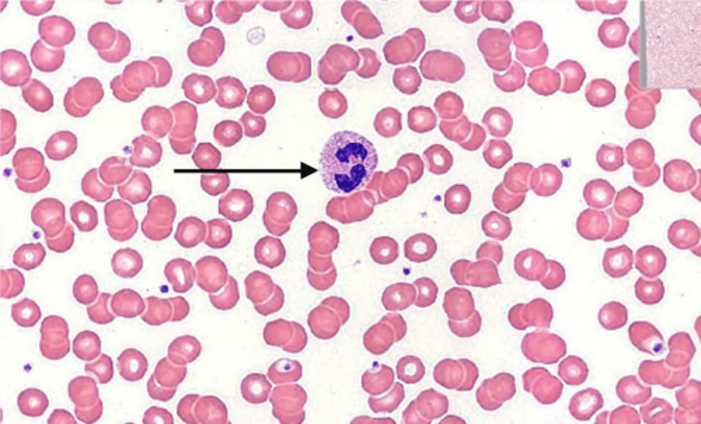 <p><strong>Abundance: </strong>Typically 1-4% in a normal blood smear</p><p></p><p><strong>Function:</strong> Involved in combating parasitic infections and modulating allergic reactions by releasing enzymes that target parasites and chemicals that reduce inflammation</p><p></p><p><strong>Granulocyte</strong></p>