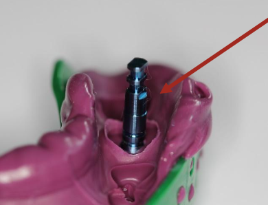 <p>In the closed tray impression technique, how do you connect the impression coping to the analog?</p>