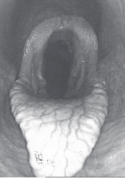 <p>Dixon Grade?</p>