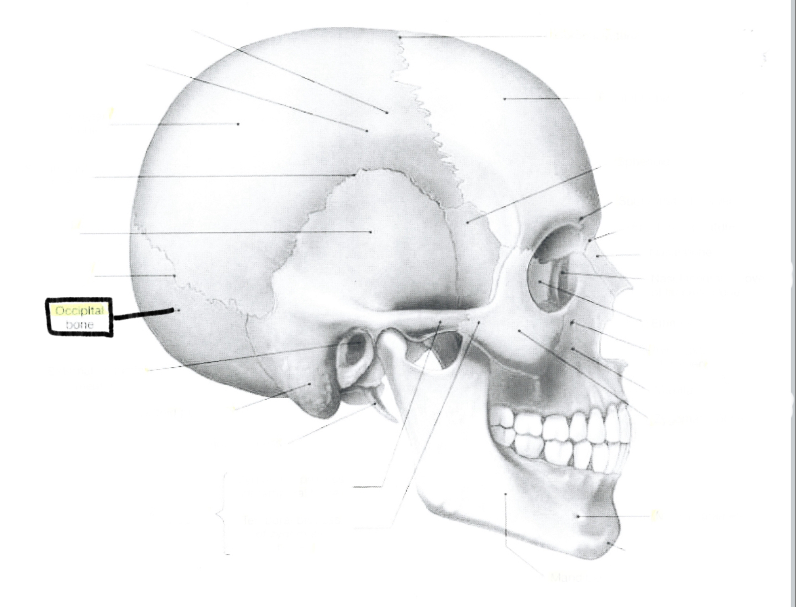 <p>Occipital bone</p>