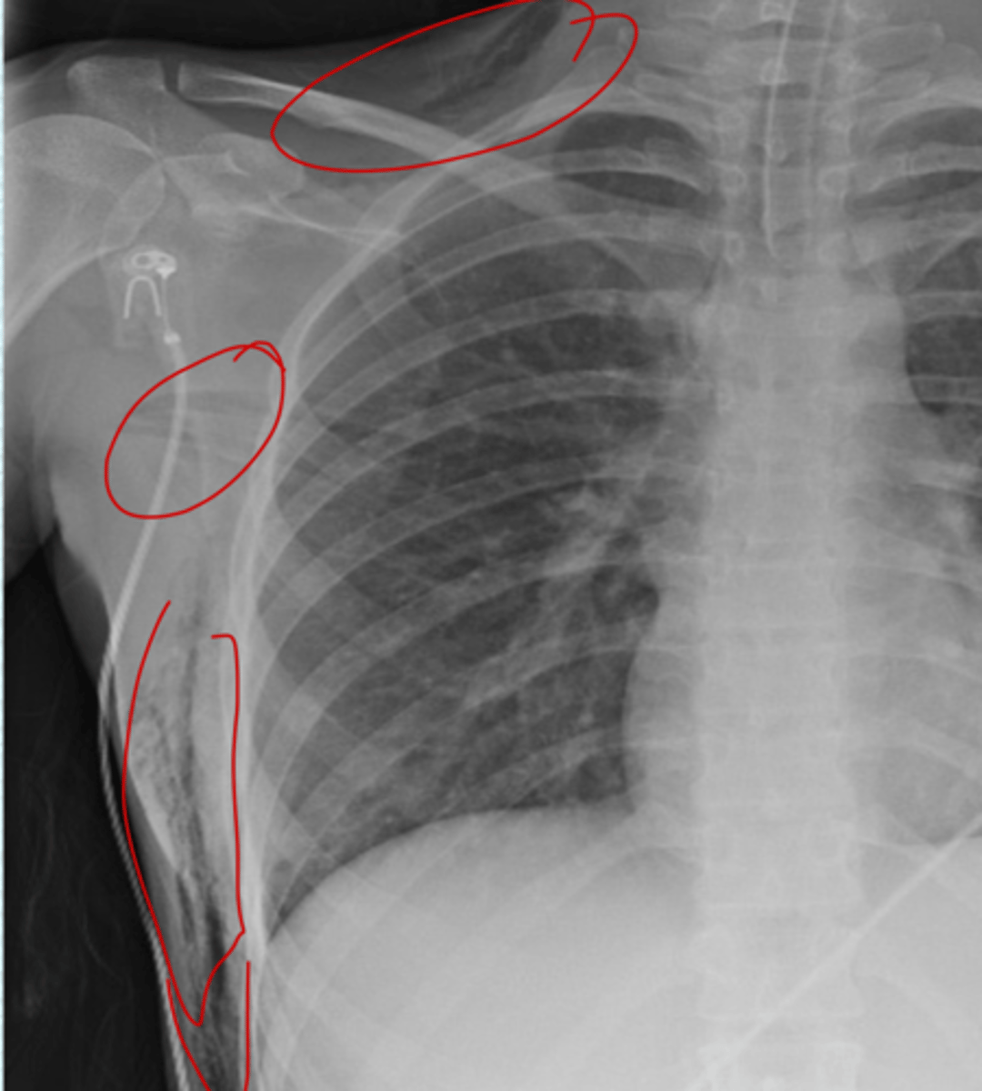 <p>what are these red circles of?</p>
