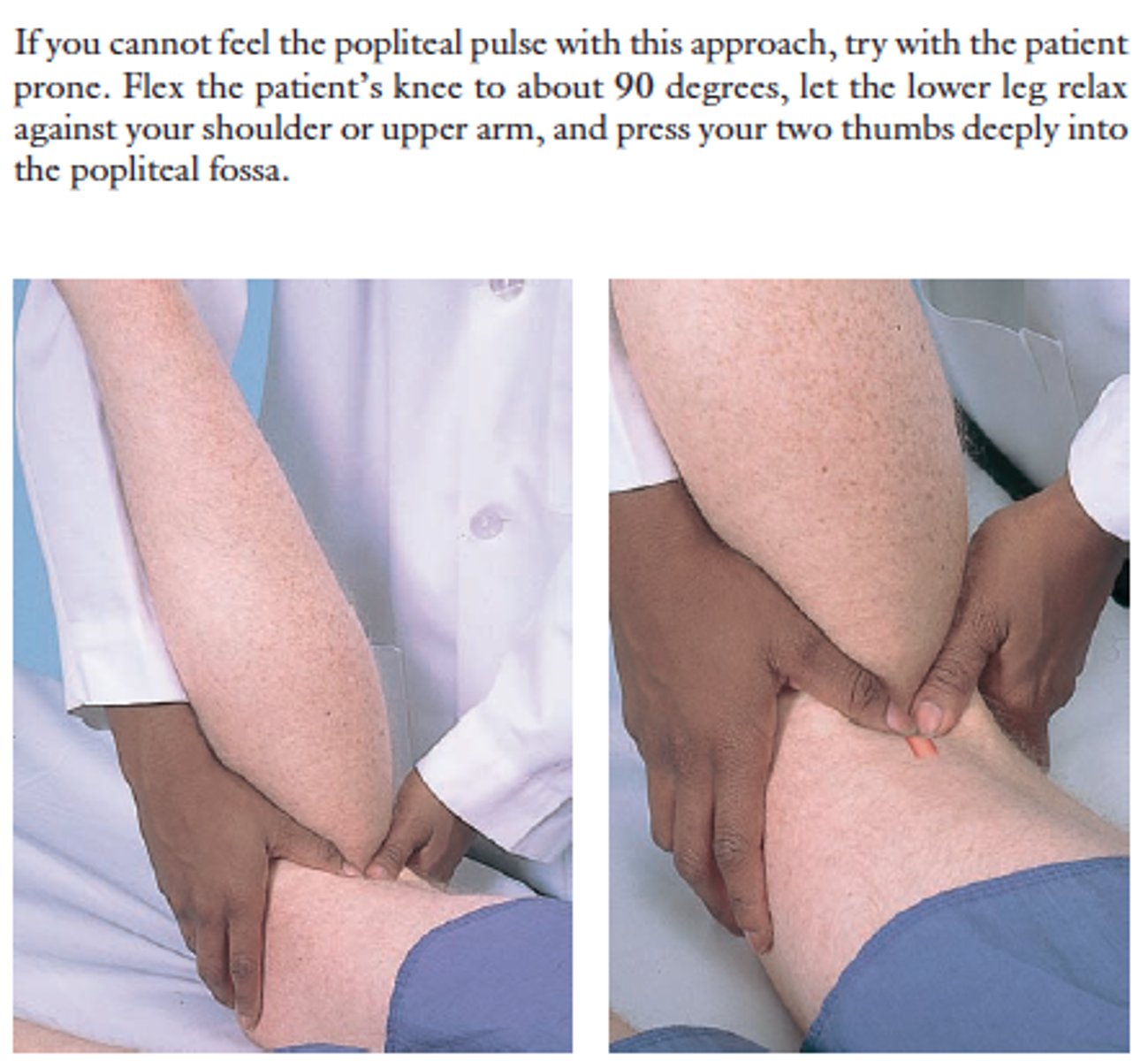 <p>Of the following effects of hydrotherapy which is not an effect of heat application?</p>