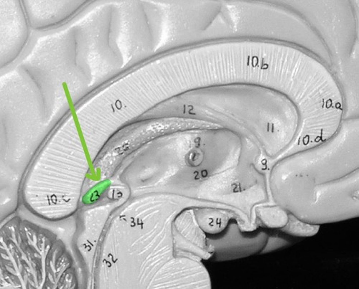 <p>Endocrine gland that secrets the hormone melatonin</p>